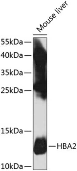Invitrogen HBA2 Polyclonal Antibody 100 &mu;L; Unconjugated:Antibodies,