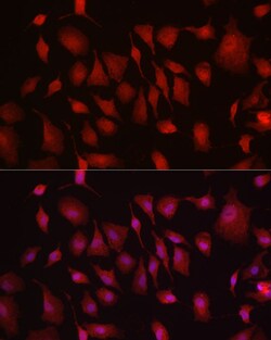 Invitrogen HK3 Polyclonal Antibody 100 &mu;L; Unconjugated:Antibodies,