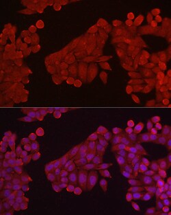 Invitrogen HK3 Polyclonal Antibody 100 &mu;L; Unconjugated:Antibodies,