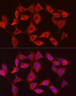 Invitrogen HK3 Polyclonal Antibody 100 &mu;L; Unconjugated:Antibodies,