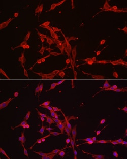 Invitrogen HK3 Polyclonal Antibody 100 &mu;L; Unconjugated:Antibodies,