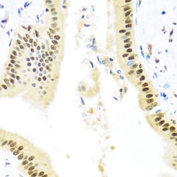 Invitrogen ZBTB17 Polyclonal Antibody 100 &mu;L; Unconjugated:Antibodies,