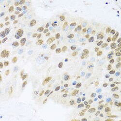 Invitrogen ZBTB17 Polyclonal Antibody 100 &mu;L; Unconjugated:Antibodies,