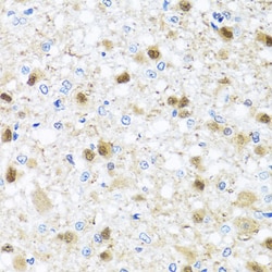 Invitrogen ZBTB17 Polyclonal Antibody 100 &mu;L; Unconjugated:Antibodies,