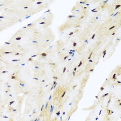 Invitrogen ZBTB17 Polyclonal Antibody 100 &mu;L; Unconjugated:Antibodies,