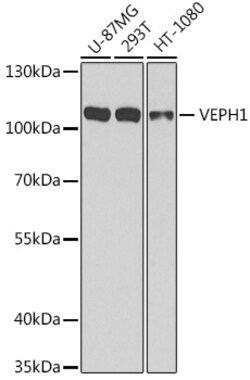Invitrogen VEPH1 Polyclonal Antibody 100 &mu;L; Unconjugated:Antibodies,