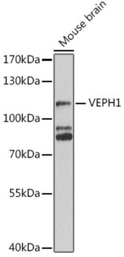 Invitrogen VEPH1 Polyclonal Antibody 100 &mu;L; Unconjugated:Antibodies,