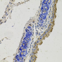 Invitrogen GAS6 Polyclonal Antibody 100 &mu;L; Unconjugated:Antibodies,