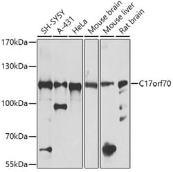 Invitrogen C17orf70 Polyclonal Antibody 100 &mu;L; Unconjugated:Antibodies,