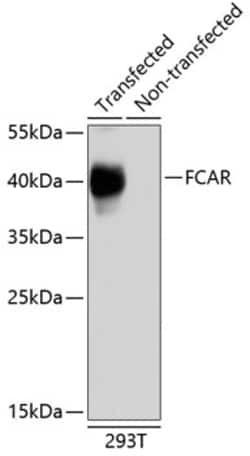Invitrogen FCAR Polyclonal Antibody 100 &mu;L; Unconjugated:Antibodies,