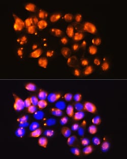 Invitrogen EPB41L2 Polyclonal Antibody 100 &mu;L | Buy Online | Invitrogen&trade; | Fisher Scientific