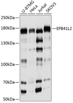 Invitrogen EPB41L2 Polyclonal Antibody 100 &mu;L | Buy Online | Invitrogen&trade; | Fisher Scientific