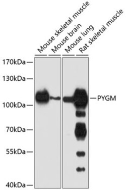 Invitrogen PYGM Polyclonal Antibody 100 &mu;L; Unconjugated:Antibodies,