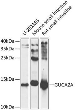Invitrogen GUCA2A Polyclonal Antibody 100 &mu;L; Unconjugated:Antibodies,