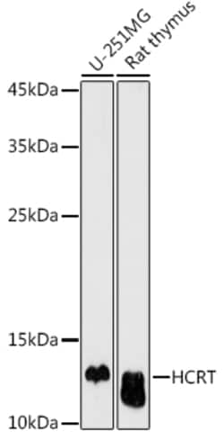Invitrogen Orexin Polyclonal Antibody 100 &mu;L; Unconjugated:Antibodies,