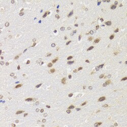 Invitrogen BAZ1B Polyclonal Antibody 100 &mu;L; Unconjugated:Antibodies,