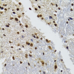 Invitrogen BAZ1B Polyclonal Antibody 100 &mu;L; Unconjugated:Antibodies,