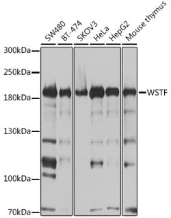 Invitrogen BAZ1B Polyclonal Antibody 100 &mu;L; Unconjugated:Antibodies,