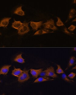 Invitrogen ATP1B2 Polyclonal Antibody 100 &mu;L; Unconjugated:Antibodies,