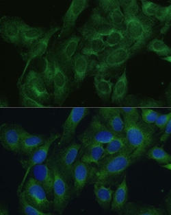 Invitrogen FRMD6 Polyclonal Antibody 100 &mu;L; Unconjugated:Antibodies,
