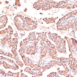Invitrogen FRMD6 Polyclonal Antibody 100 &mu;L; Unconjugated:Antibodies,