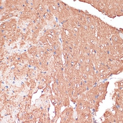 Invitrogen FRMD6 Polyclonal Antibody 100 &mu;L; Unconjugated:Antibodies,