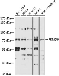 Invitrogen FRMD6 Polyclonal Antibody 100 &mu;L; Unconjugated:Antibodies,