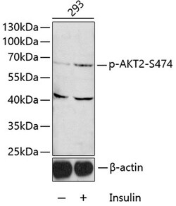 Invitrogen Phospho-AKT2 (Ser474) Polyclonal Antibody 100 &mu;L; Unconjugated:Antibodies,