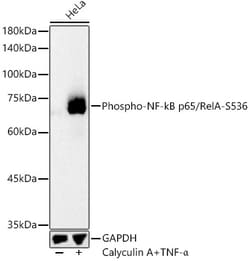 Invitrogen Phospho-NFkB p65 (Ser536) Polyclonal Antibody 100 &mu;L; Unconjugated:Antibodies,