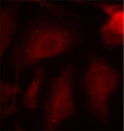 Invitrogen Phospho-Tau (Ser404) Polyclonal Antibody 100 &mu;L; Unconjugated:Antibodies,