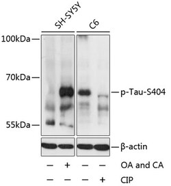 Invitrogen Phospho-Tau (Ser404) Polyclonal Antibody 100 &mu;L; Unconjugated:Antibodies,