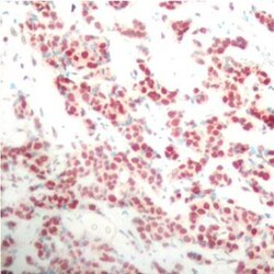 Invitrogen Phospho-NFkB p100 (Ser866) Polyclonal Antibody 100 &mu;L; Unconjugated:Antibodies,