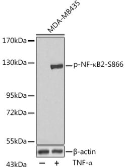 Invitrogen Phospho-NFkB p100 (Ser866) Polyclonal Antibody 100 &mu;L; Unconjugated:Antibodies,