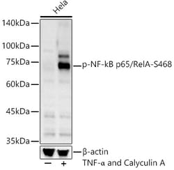 Invitrogen Phospho-NFkB p65 (Ser468) Polyclonal Antibody 100 &mu;L; Unconjugated:Antibodies,