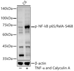 Invitrogen Phospho-NFkB p65 (Ser468) Polyclonal Antibody 100 &mu;L; Unconjugated:Antibodies,