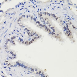 Invitrogen Phospho-STAT3 (Ser727) Polyclonal Antibody 100 &mu;L; Unconjugated:Antibodies,