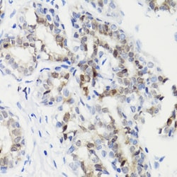 Invitrogen Phospho-STAT3 (Ser727) Polyclonal Antibody 100 &mu;L; Unconjugated:Antibodies,