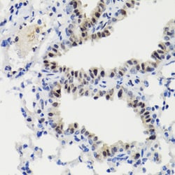 Invitrogen Phospho-STAT3 (Ser727) Polyclonal Antibody 100 &mu;L; Unconjugated:Antibodies,