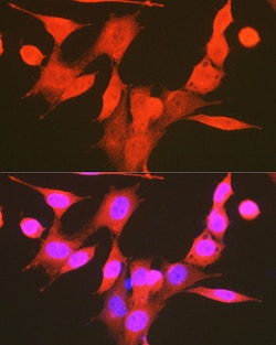 Invitrogen Phospho-PDPK1 (Ser241) Polyclonal Antibody 100 &mu;L; Unconjugated:Antibodies,