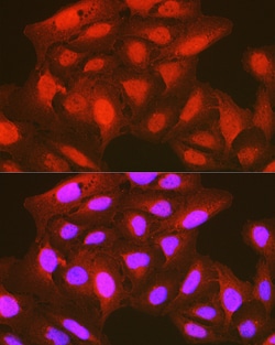 Invitrogen Phospho-PDPK1 (Ser241) Polyclonal Antibody 100 &mu;L; Unconjugated:Antibodies,