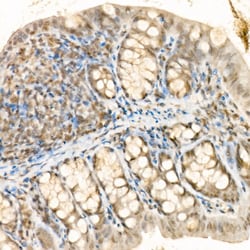 Invitrogen Phospho-YAP1 (Ser127) Polyclonal Antibody 100 &mu;L; Unconjugated:Antibodies,