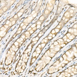 Invitrogen Phospho-YAP1 (Ser127) Polyclonal Antibody 100 &mu;L; Unconjugated:Antibodies,