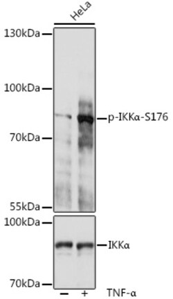 Invitrogen Phospho-IKK alpha (Ser176) Polyclonal Antibody 100 &mu;L; Unconjugated:Antibodies,