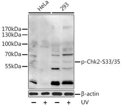 Invitrogen Phospho-CHK2 (Ser33, Ser35) Polyclonal Antibody 100 &mu;L; Unconjugated:Antibodies,