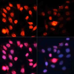 Invitrogen Phospho-p70 S6 Kinase (Thr389) Polyclonal Antibody 100 &mu;L;
