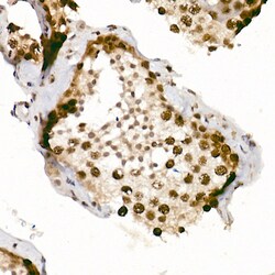Invitrogen Phospho-ATR (Ser428) Polyclonal Antibody 100 &mu;L; Unconjugated:Antibodies,