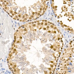 Invitrogen Phospho-ATR (Ser428) Polyclonal Antibody 100 &mu;L; Unconjugated:Antibodies,