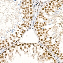 Invitrogen Phospho-ATR (Ser428) Polyclonal Antibody 100 &mu;L; Unconjugated:Antibodies,