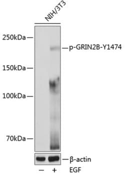 Invitrogen Phospho-NMDAR2B (Tyr1474) Polyclonal Antibody 100 &mu;L | Buy Online | Invitrogen&trade; | Fisher Scientific