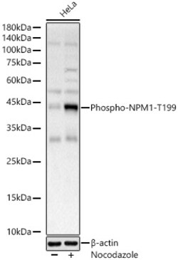 Invitrogen Phospho-NPM1 (Thr199) Polyclonal Antibody 100 &mu;L; Unconjugated:Antibodies,